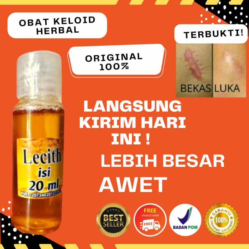 PENGHILANG KELOID AMPUH PENUMPAS DAGING TUMBUH BEKAS LUKA LECITH 20 ML