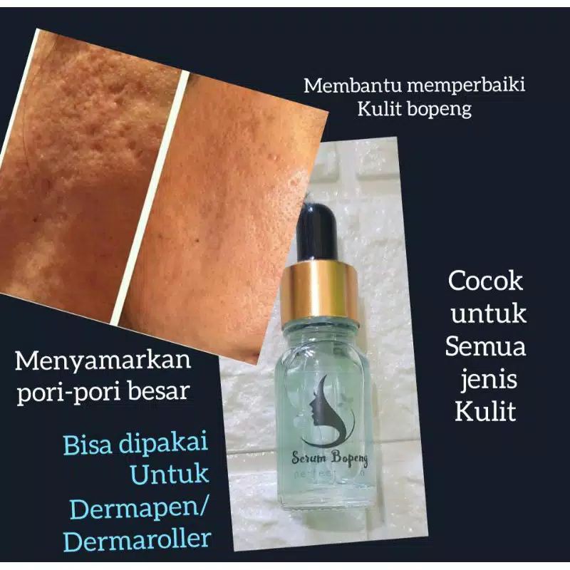 serum bopeng dermapen