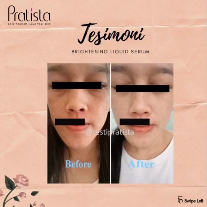 Pratista Brightening Liquid Serum Untuk Flek Kemerahan &amp; Bekas Jerawat