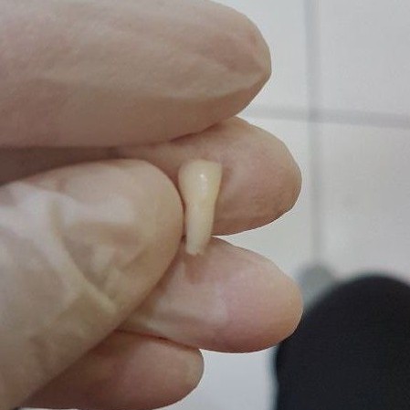 [SULUNG/SUSU] GIGI ASLI MANUSIA SERI / INCISIVUS SUSU / SULUNG / ANAK UNTUK PRAKTIKUM