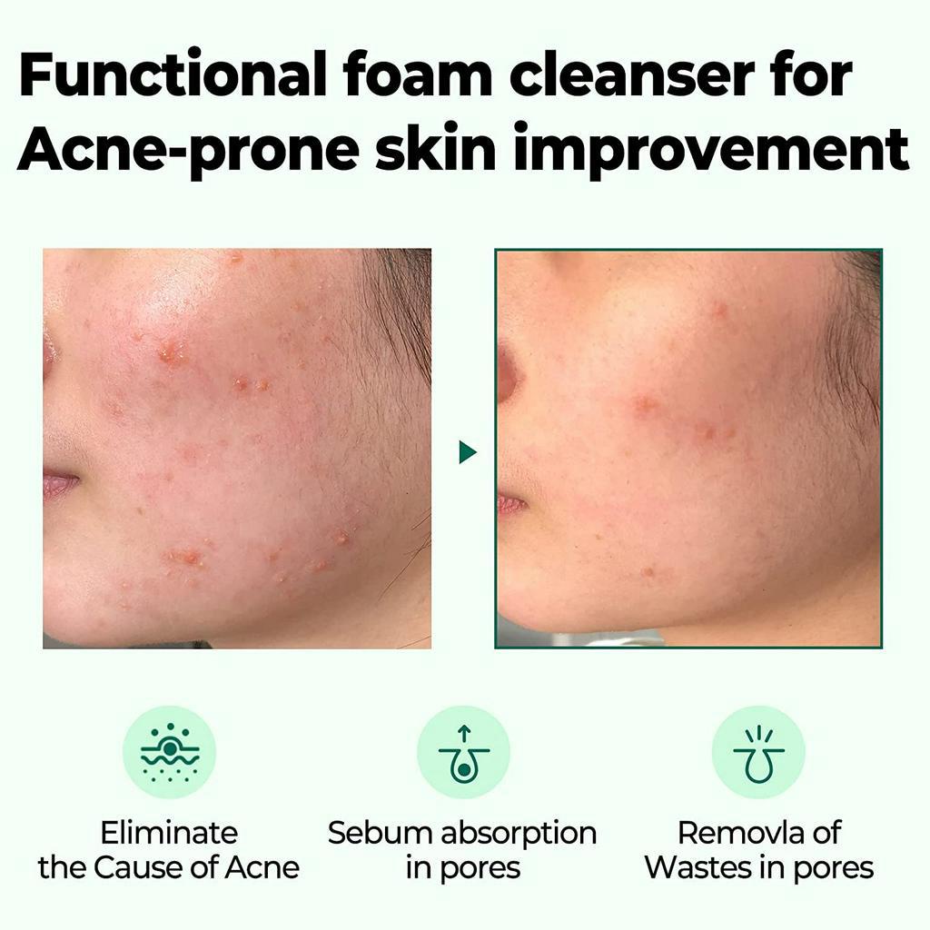 SOME BY MI 30 Days Miracle Acne Clear Foam Cleanser