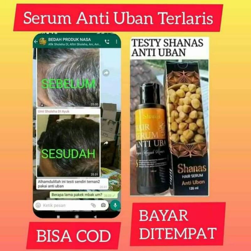 Serum Anti Uban Nasa