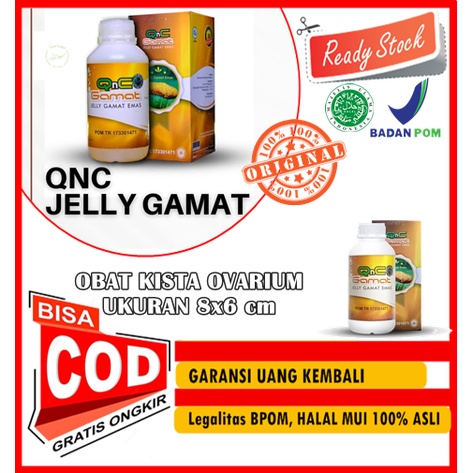 OBAT KISTA OVARIUM UKURAN 8x6 cm, MENGHILANGKAN KISTA OVARIUM SUDAH BESAR TANPA OPERASI - MIOM, OBAT