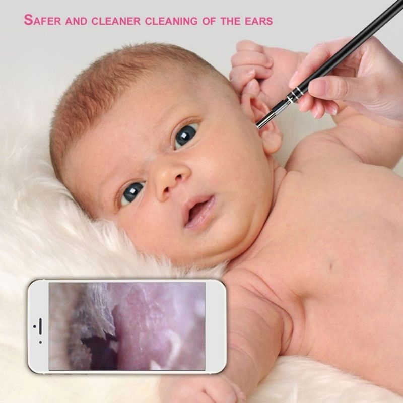 Pembersih Telinga Kamera - Ear Cleaning Endoscope USB Camera Korek Kuping Kamera Endoscope