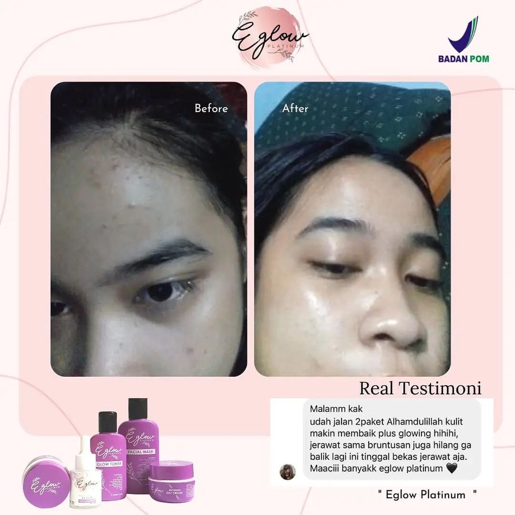 ( SALE JUAL CEPAT ) Eglow Skincare Original