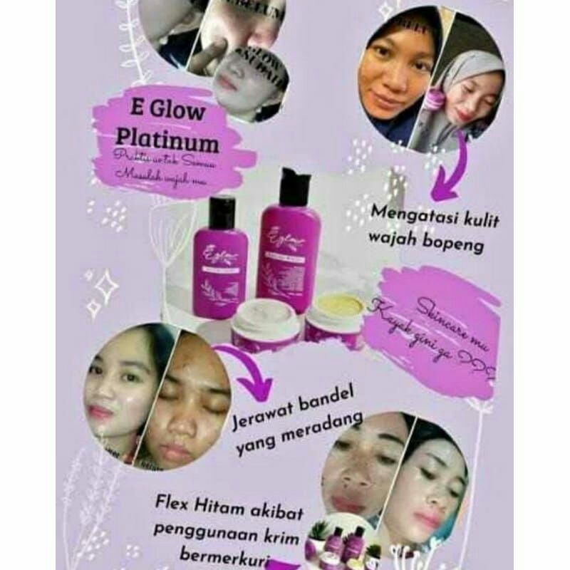 

Eglownew