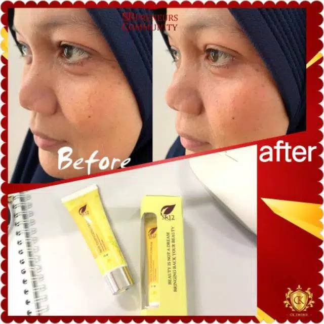 TIGHTENING CREAM SR12 / WHITENING TERBAIK / PENCERAH WAJAH / PENGENCANG ANTI KERUT WAJAH / HERBAL TIGHTENING CREAM SR12 / Krim hilangkan kerutan dalam 10 menit  Skin Tightening krim sr12