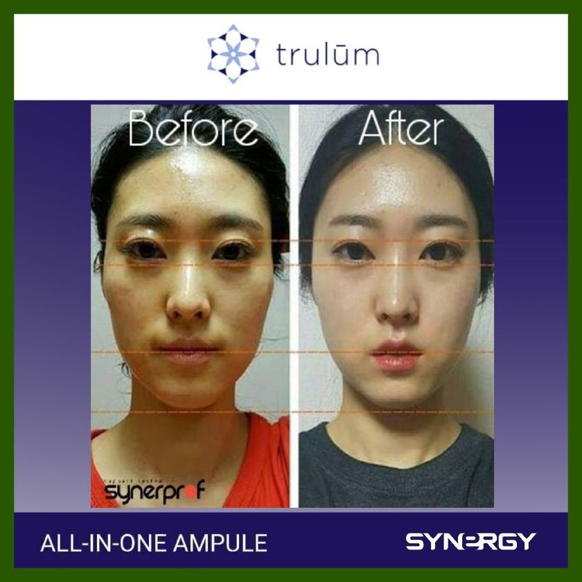 Trulum Pemutih Wajah Cepat Aman Alami Trulum Spray Pemutih Wajah Cepat