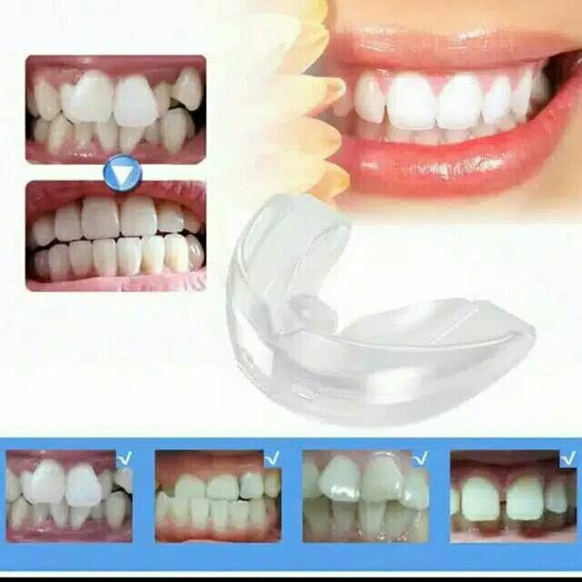 TEETH TRAINER ALIGNMENT - SILICONE ORTHODENTIC RETAINER - PERATA GIGI PREMIUM