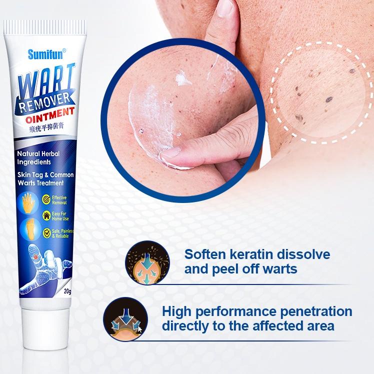 [SUL.10Jn22ĸ] Warts Remover Cream Wart Treatment Skin Tags Mole Remover Plaster Cream Antibacterial 