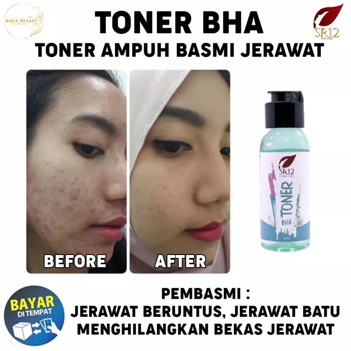 Toner SR12 | Toner AHA SR12 &amp; Toner BHA SR12 | Toner Wajah SR12 Skincare | Pembersih Wajah SR12