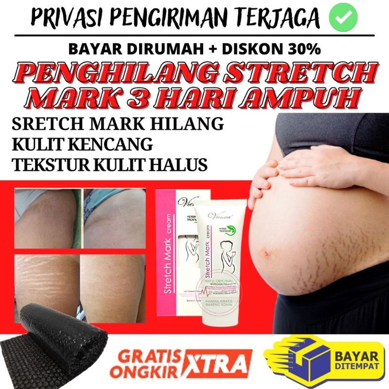 KRIM PENGHILANG STRETCH MARK