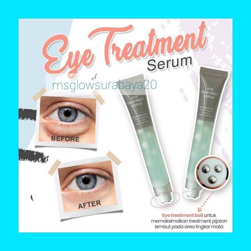 Serum Eye Treatment Ms Glow eye dark cyrcle msglow asli ori eye cream original Ms Glow