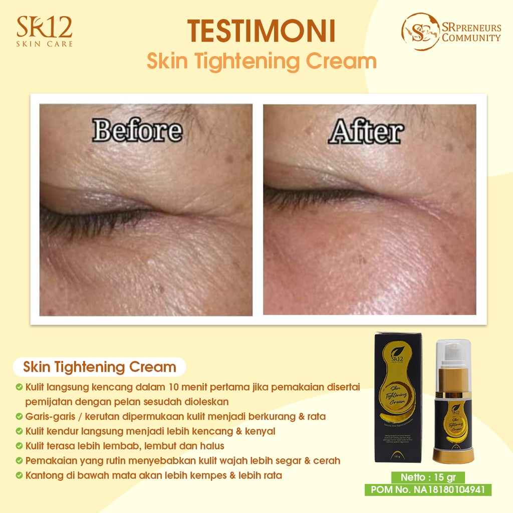 SR12 HERBAL SKINCARE TIGHTENING CREAM WHITENING TERBAIK PENCERAH WAJAH / PENGENCANG ANTI KERUT WAJAH