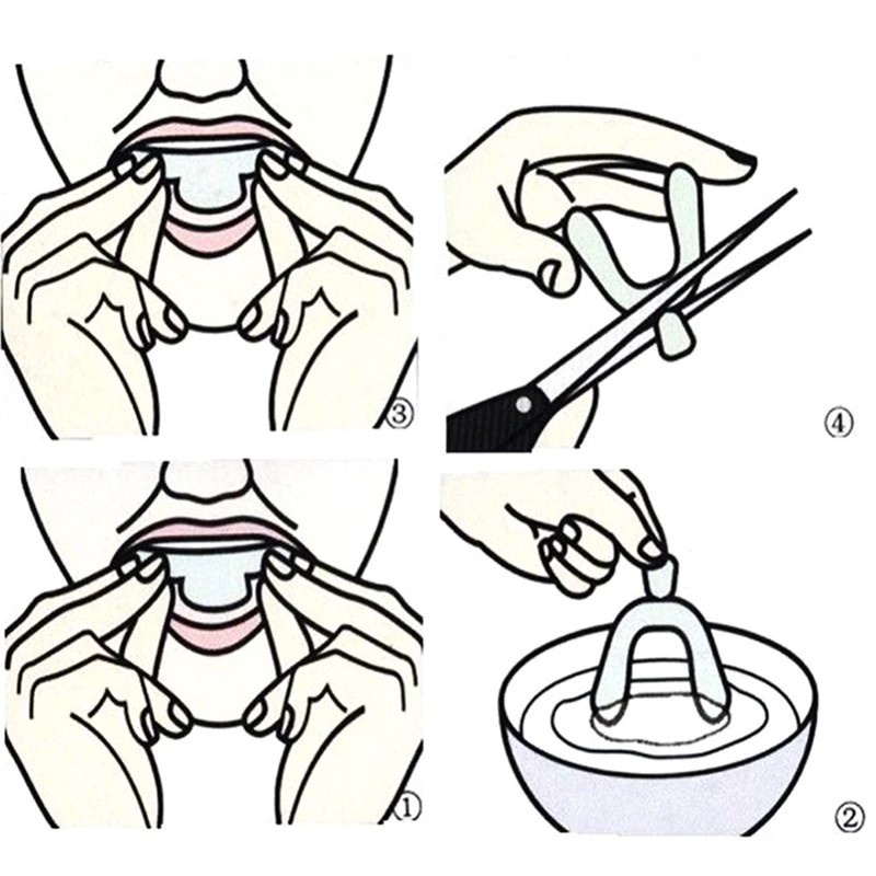 Alat Pemutih Gigi Behel Gigi Kuning Behel Teeth Whitening