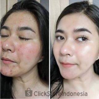 PAKET SKINCARE KOREA SKIN CARE PERAWATAN PEMUTIH WAJAH ...