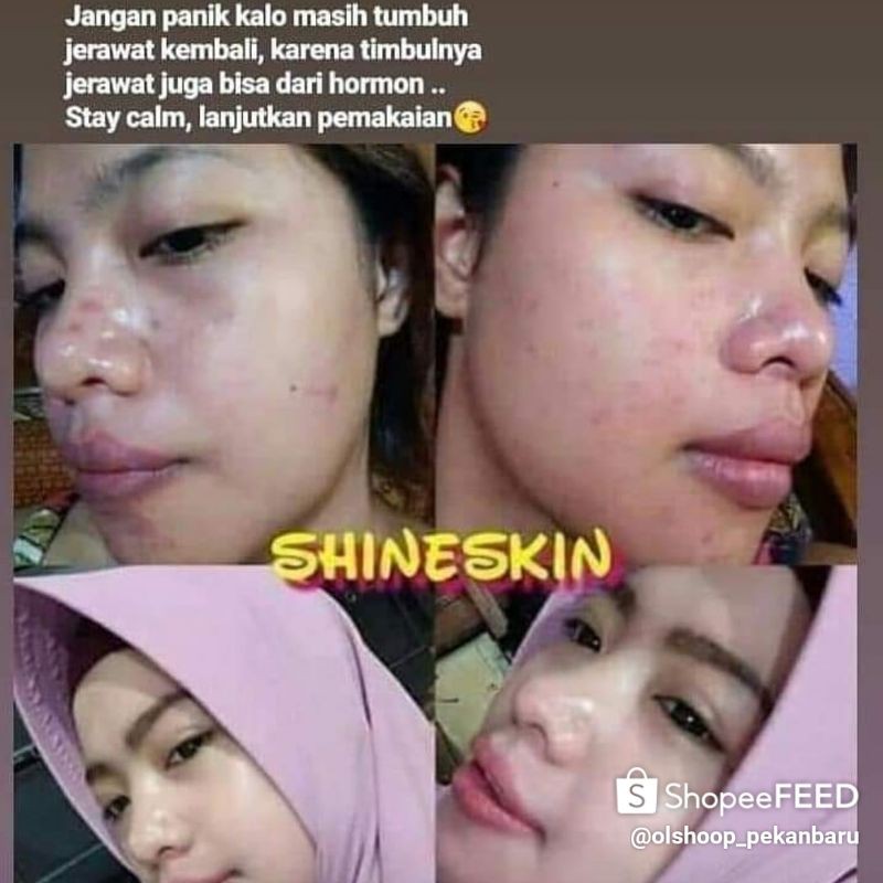 shineskin skincare