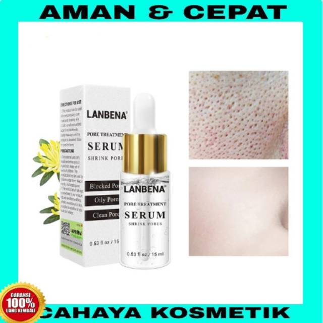 LANBENA PORE TREATMENT SERUM / SERUM PERAPAT PORI-PORI WAJAH