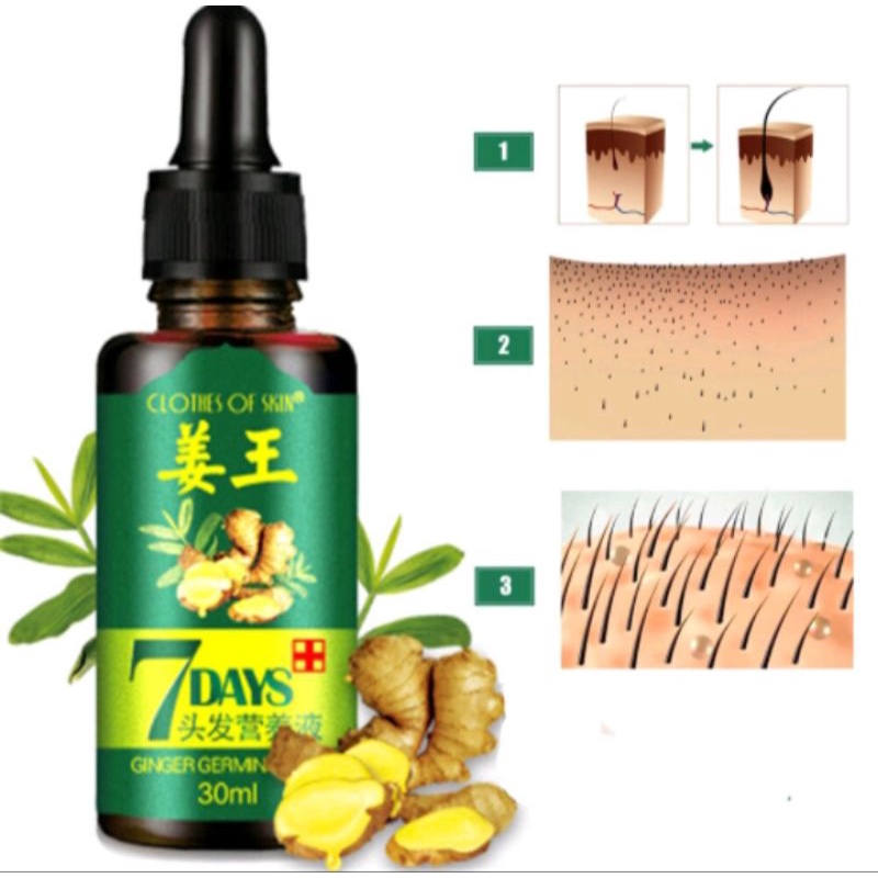 Serum 7 Days Ginger Penumbuh Rambut Anti Rontok