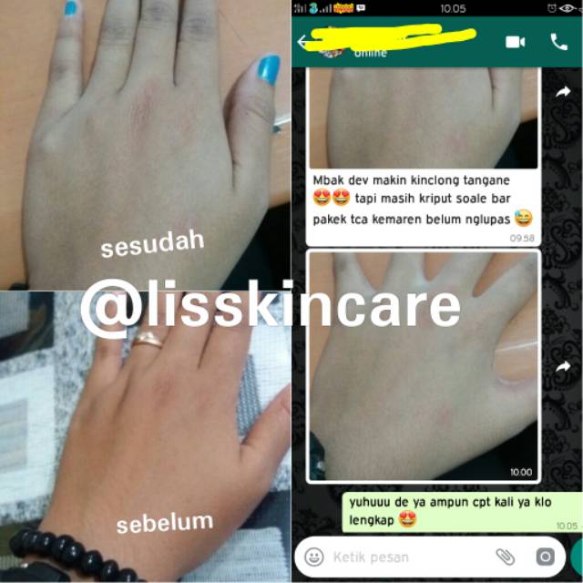 PROMO HB WHITENING BPOM DOSIS TINGGI ANTI STREATMARK / BACA DESKRIPSI / BERKUALITAS di jamin putih dan ori 100% dosis tinggi / Ampuh Putih