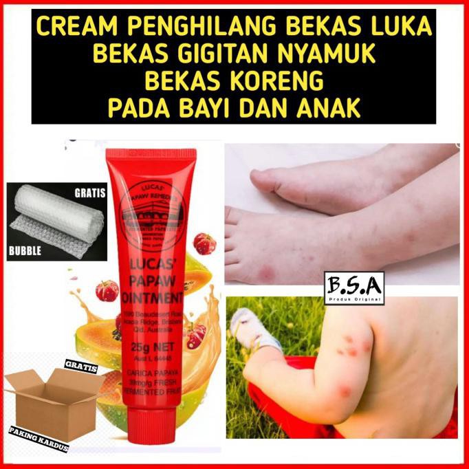 CREAM PENGHILANG BEKAS LUKA BEKAS GIGITAN NYAMUK PADA BAYI DAN ANAK