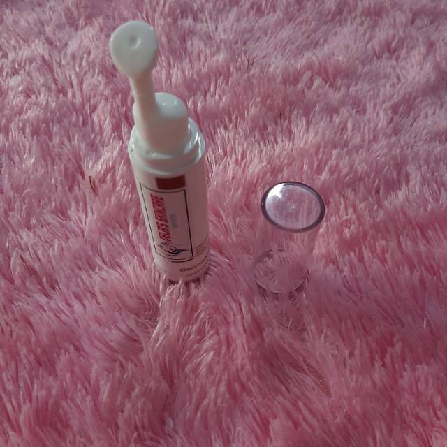 Serum jerawat bopeng