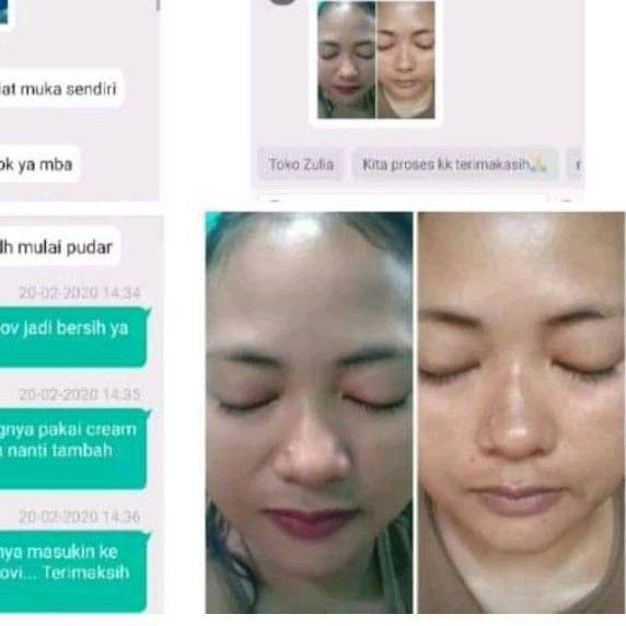 ♤ Flek dr Liz / Lis night Cream / Liz night whitening / saleb flek Lis skincare ✷