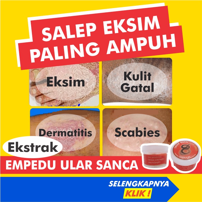 Salep Obat Gatal Eksim Kering Menahun Paling Ampuh Saleb Kulit Gatel Exim Basah Selangkangan Kurap K