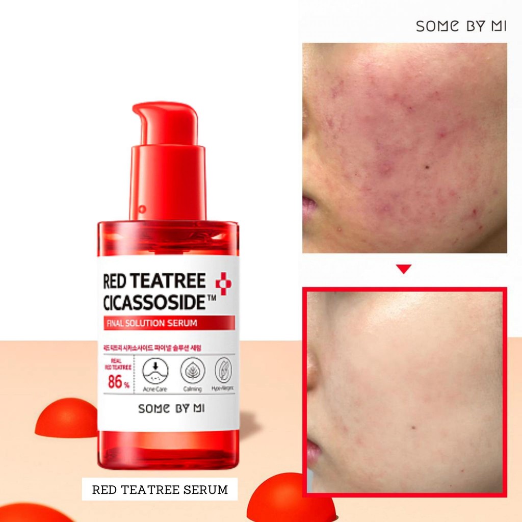 [PROMO SPESIAL] SOME BY MI RED TEATREE CICASSOSIDE FINAL SOLUTION SERUM 50ml 100% ORI KOREA SOMEBYMI