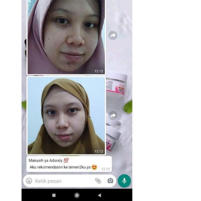 ✪ [BONUS POUCH] ADORALY SKINCARE ORIGINAL - Skincare Kecantikan Wajah BPOM - Glowing Maksimal ☆