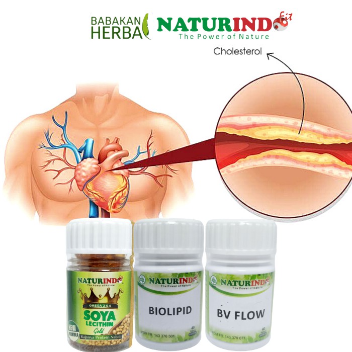 

Naturindo Herbal Kolesterol Obat Kolesterol Tinggi Ampuh