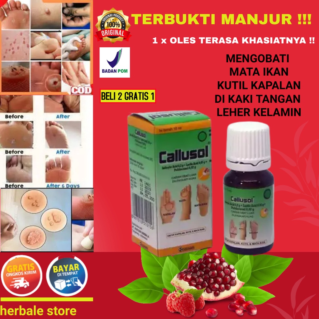 OBAT MATA IKAN TELAPAK KAKI KUTIL KAPALAN TANGAN KAKI LEHER KELAMIN PALING AMPUH UNTUK PRIA DAN WANI