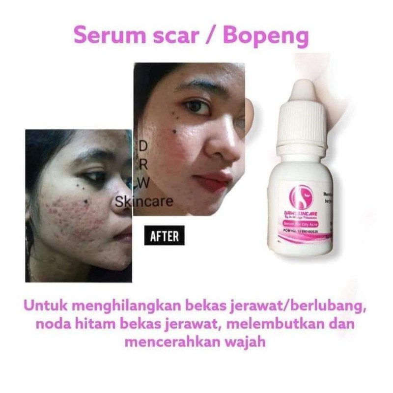 DRW SKINCARE ORIGINAL 100% ORIGINAL BPOM Serum Scar