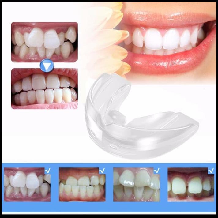 Orthodontic Trainer Perapi Gigi Pengganti Behel Dewasa - Alat Perapi Gigi Tanpa Behel Ortho Trainer Alignment Biru
