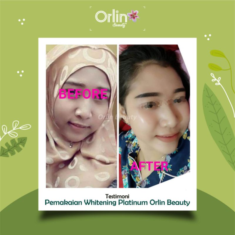 ORLIN/PAKET WHITENING PLATINUM/PAKET ORLIN/PAKET BRIGHTENING ORLIN/PEMUTIH WAJAH KULIT NOMAL/CREAM BPOM/SKINCARE BUMIL/SKINCARE BUSUI/ORLIN BEAUTY/BONUS GIFT-5