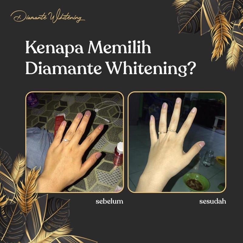 DIAMANTE WHITENING CAPSUL PEMUTIH SELURUH BADAN TERBUKTI | KAPSUL PEMUTIH COLLAGEN PEPTIDE