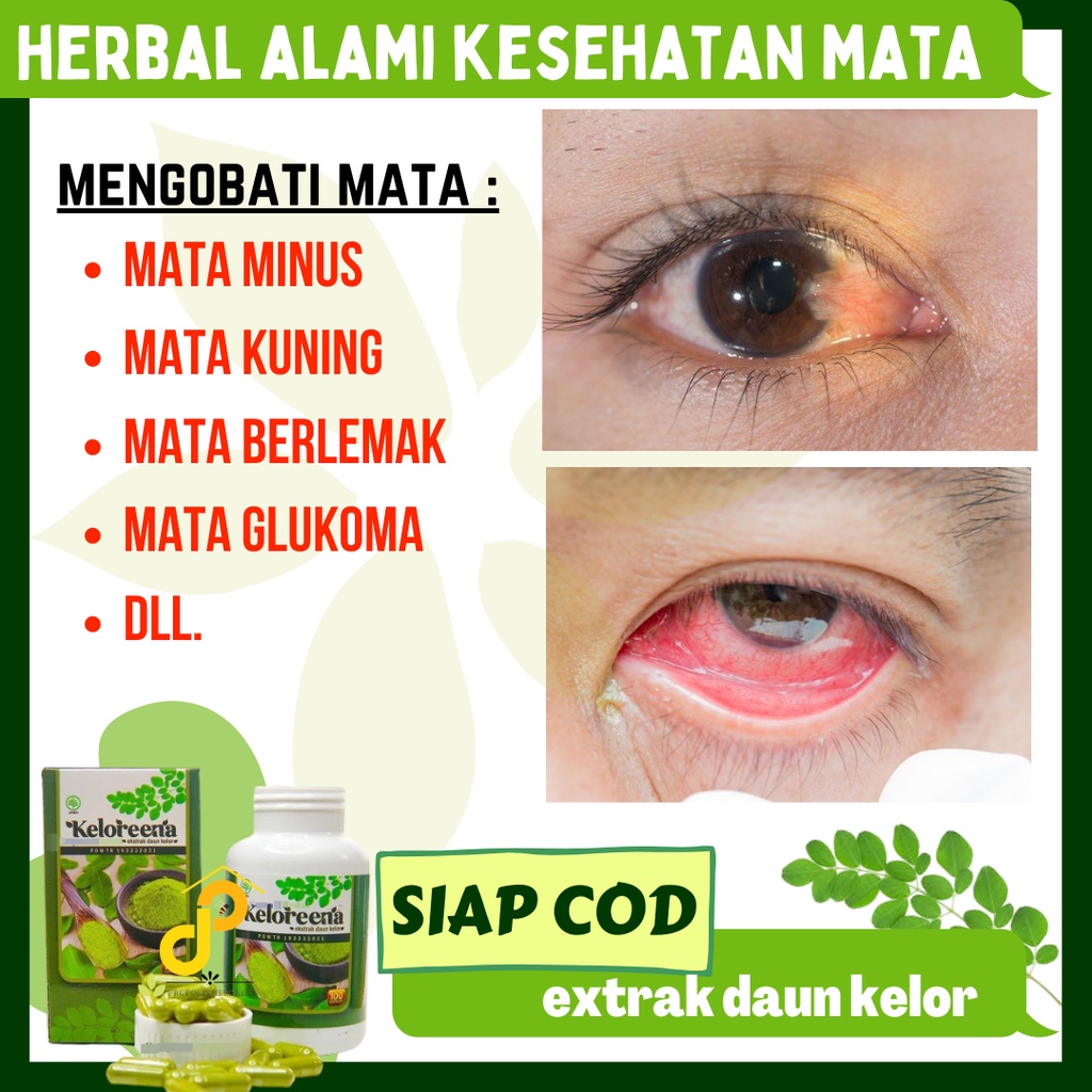 Keloreena | Obat Mata Glaukoma akut Obat glaukoma menahun obat penglihatan kabur obat apotik mata gl