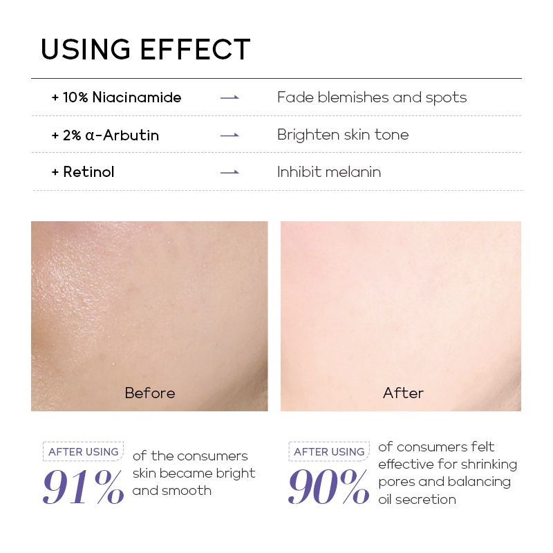 Fenyi Lab 10% Niacinamide Brightening Serum Retinol Mengecilkan Pori-pori Anti Kemerahan 17ml