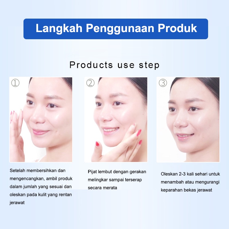 Cream Obat Jerawat Paling Ampuh ​Acne Rejuvenation Cream Jerawat Krim Jerawat Menghilangkan Jerawat Cepat Menghilangkan Jerawat Removal of Acne Cream Untuk Memperbaiki Kulit Denga Krim Penghilang Jerawat dan Bekas Jerawat Pria dan Wanita 30g