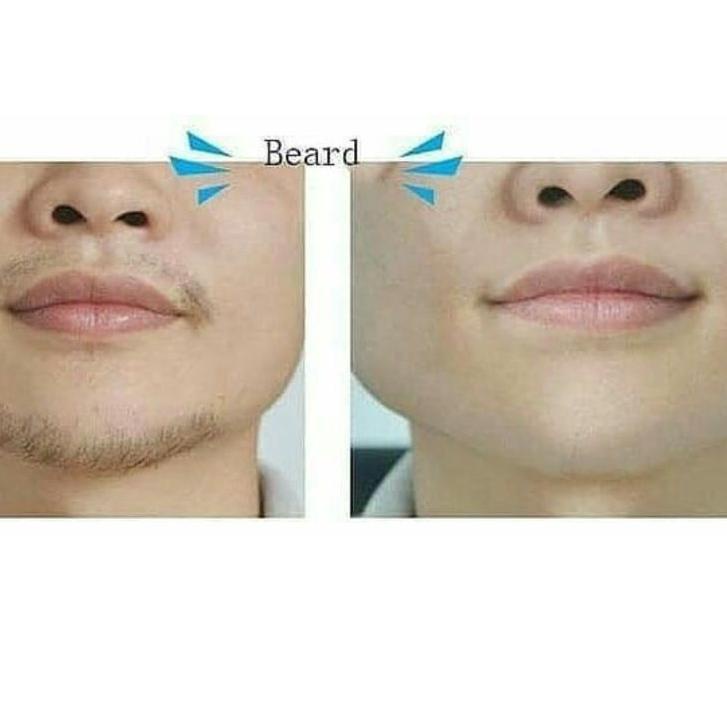 Termurah HAVANA Perontok Penghilang Bulu Wajah Kumis Jenggot Brewok ketiak kemaluan Permanen Hair re