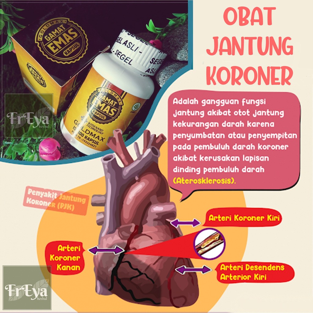  OBAT  JANTUNG KORONER EFEKTIF ATASI PENGERASAN ARTERI DAN 