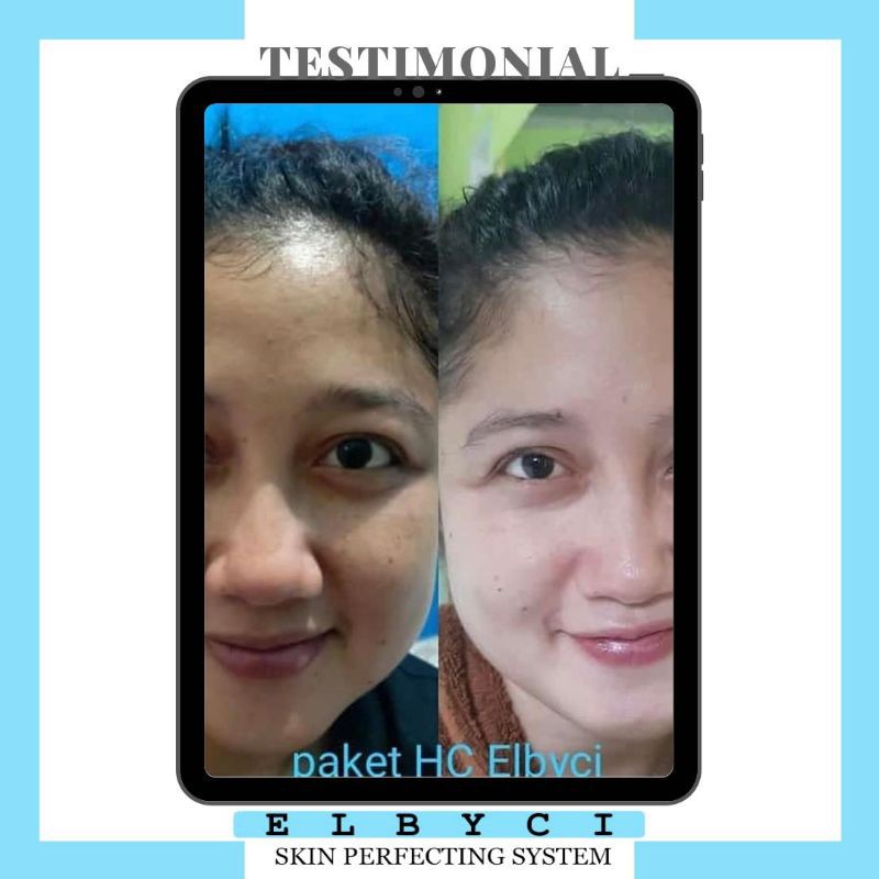 Paket HC Elbyci Skincare