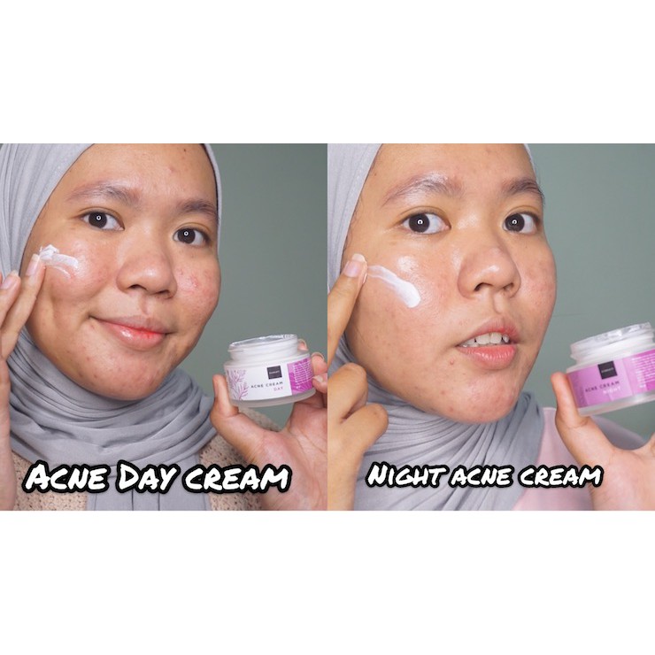 [ORI] Scarlett Whitening Acne Cream Day/Night dengan Kandungan Double Action Salicylic Acid untuk Meredakan Peradangan Jerawat - BPOM 20 Gram