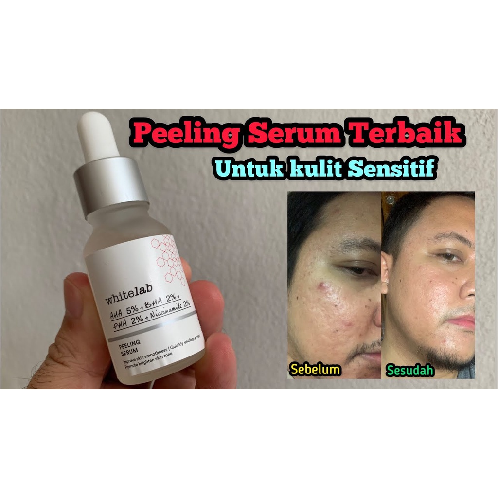 [ORI] Whitelab Peeling Serum AHA BHA PHA Cocok Digunakan untuk Pemula &amp; Kulit Sensitif I BPOM 20ml