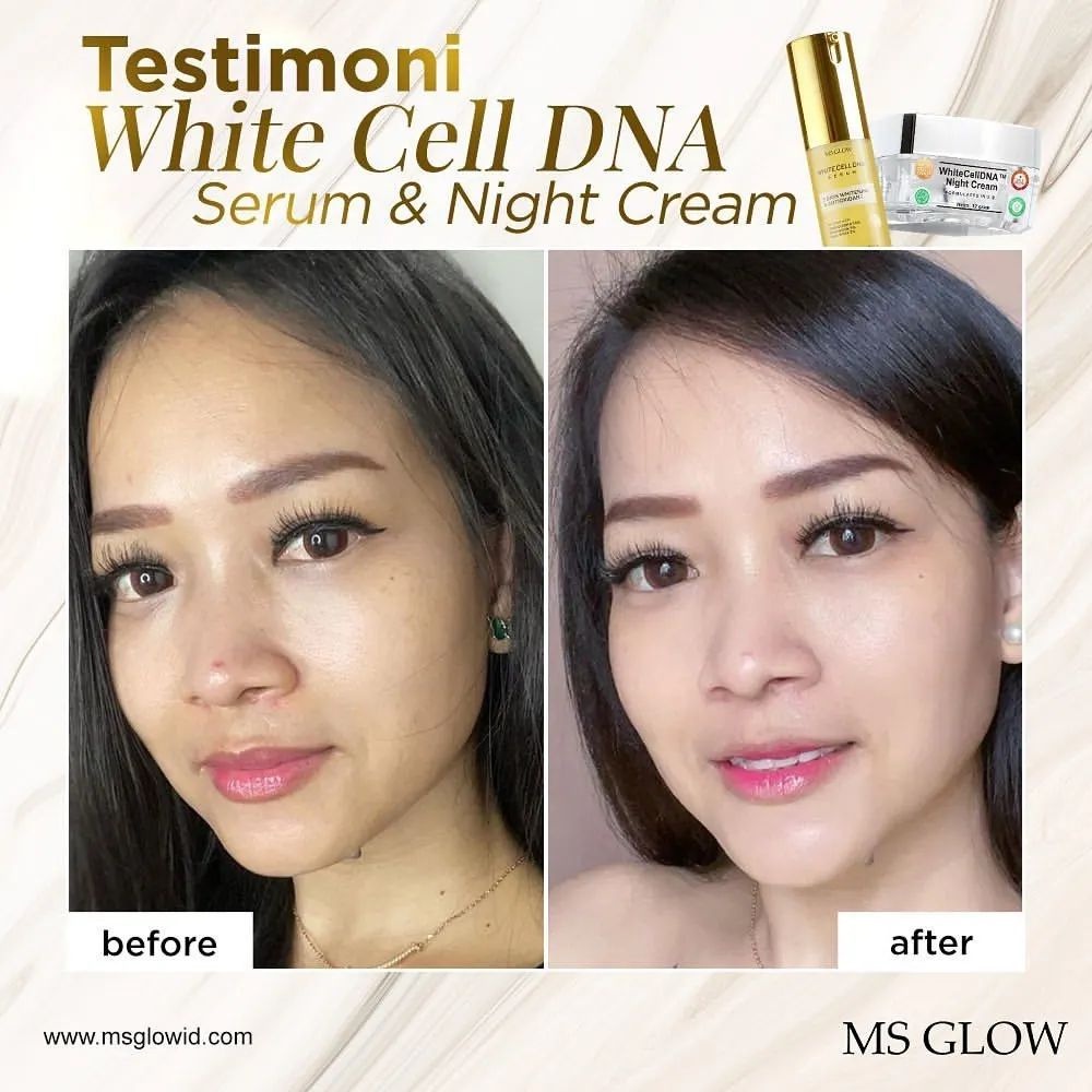 PAKET WHITE CELL DNA MS GLOW 100% ORIGINAL PAKET WAJAH MS GLOW + Serum white cell DNA