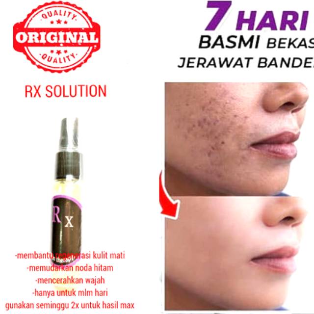 TONER FLEK RX SOLUTION 25ML PENGHAPUS FLEK