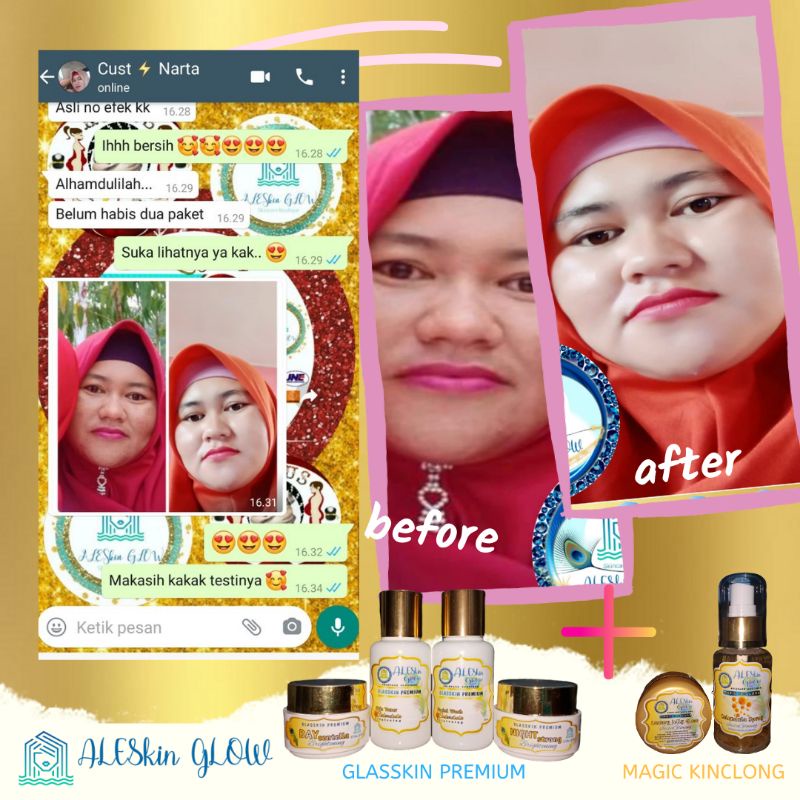 PAKET MAXI GLOW ALESKIN GLOW Skincare Glowing-Paket Perawatan Wajah Korea-Cream Glowing