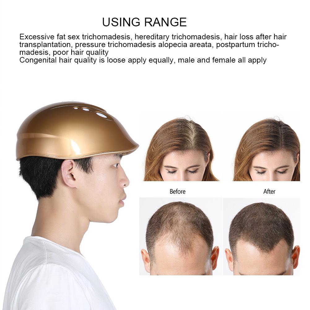 160 Diodes Laser Hair Growth Regrowth Helmet Lllt Therapy Hair