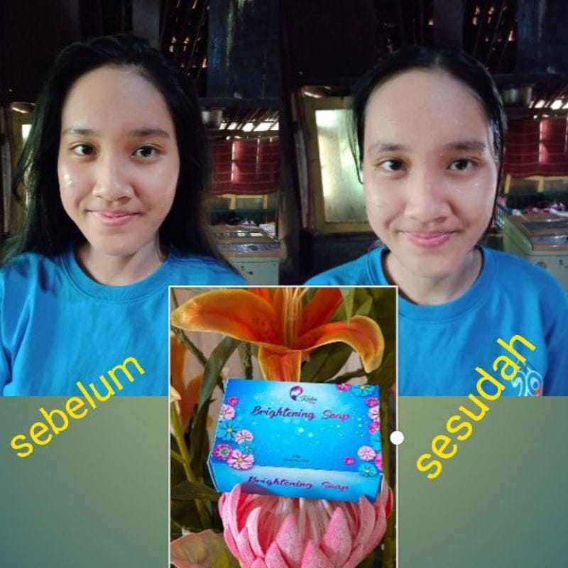 Sabun Kedas Beauty Original BPOM Kedas Beauty Sepaket Gold Jelly Kedas Beauty Paket Kedas Beauty-3