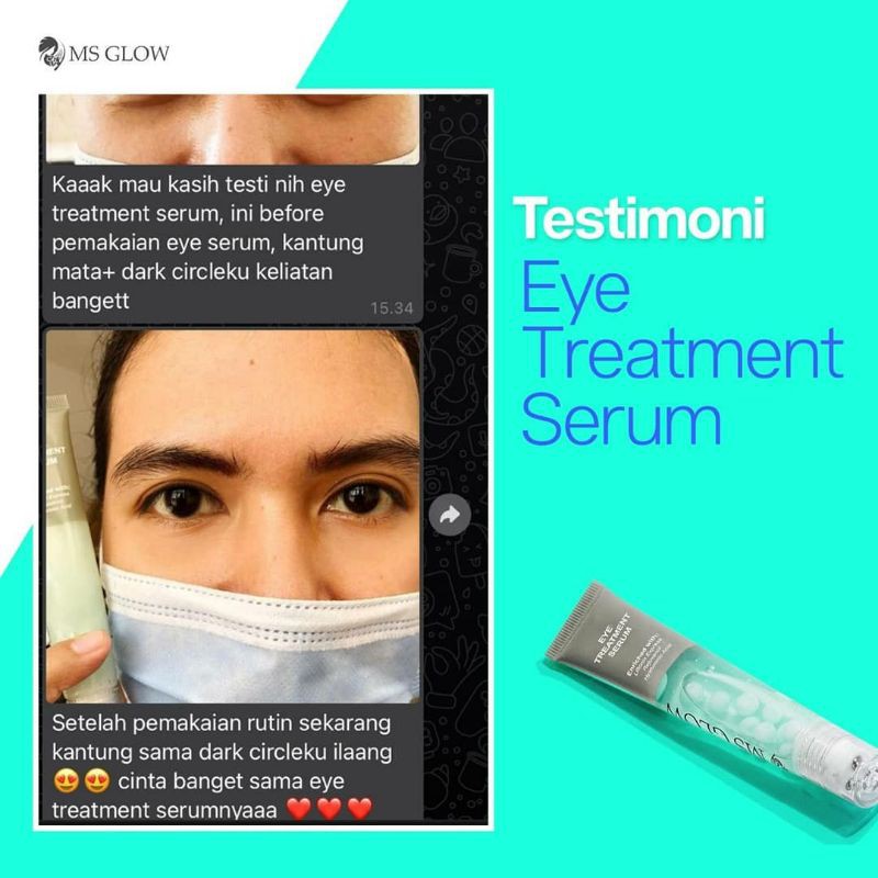 MS Glow Eye Serum - Eye Treatment Serum Ms Glow - Serum Mata Panda